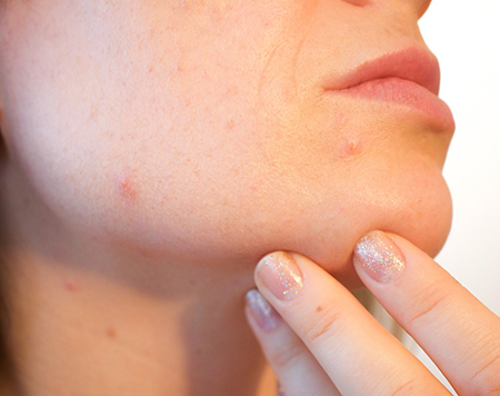arreter-de-se-maquiller-pour-stopper-les-boutons